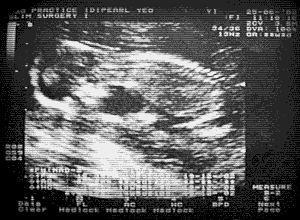 Pearl Preggy Scan