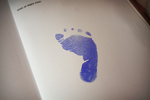 20100912_clara06 Clara's right foot